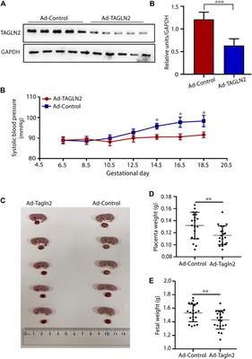 TAGLN2-Regulated Trophoblast Migration, Invasion and Fusion are Impaired in Preeclampsia